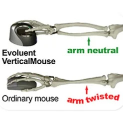 Evoluent VerticalMouse 4 Right Wireless - Optical - Wireless - Radio Frequency - 2.40 GHz - Black - USB - VM4RW